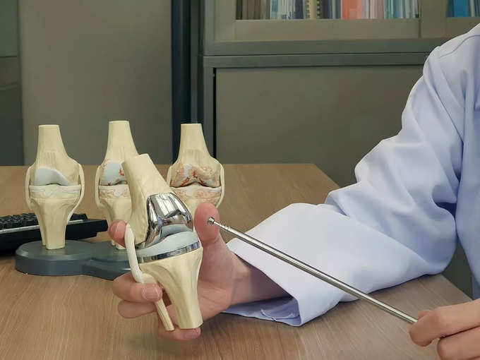 Knee Replacement Surgery: कैसे बदला जाता है खराब घुटना, कितने दिन में चलने लगता है मरीज, VIDEO में डॉ. से जाने - orthopedic surgeon explained full procedure of knee replacement surgery and their advantage and disadvantage