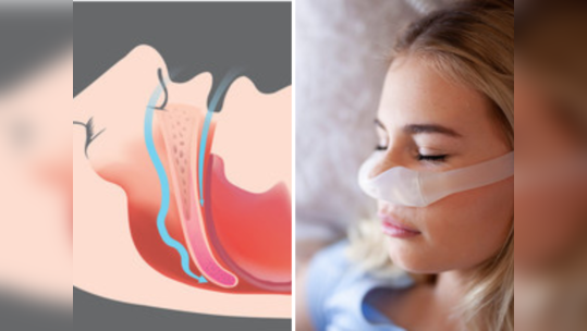 घोरण्याकडे दुर्लक्ष करू नका, हे आहे Obstructive Sleep Apnea चे पहिले लक्षण