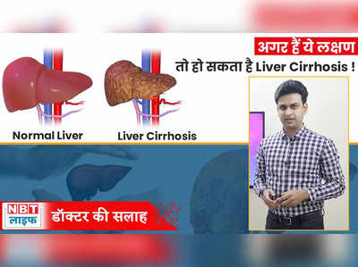 Liver Cirrhosis Cause and Treatment : डॉक्टर से जानें क्या होता है लीवर सिरोसिस