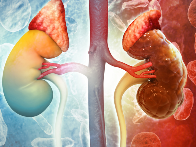 Diabetes affects the kidneys