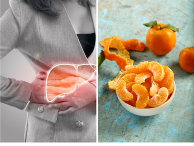 Fatty Liver में फैटी एसिड कम करने के लिए क्या खाना चाहिए?