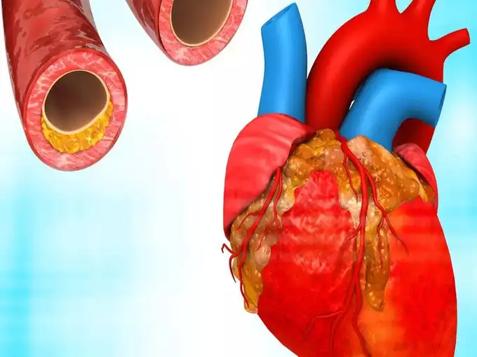 Almond is the enemy of cholesteroldiabetes, AIIMS Dr. told 5