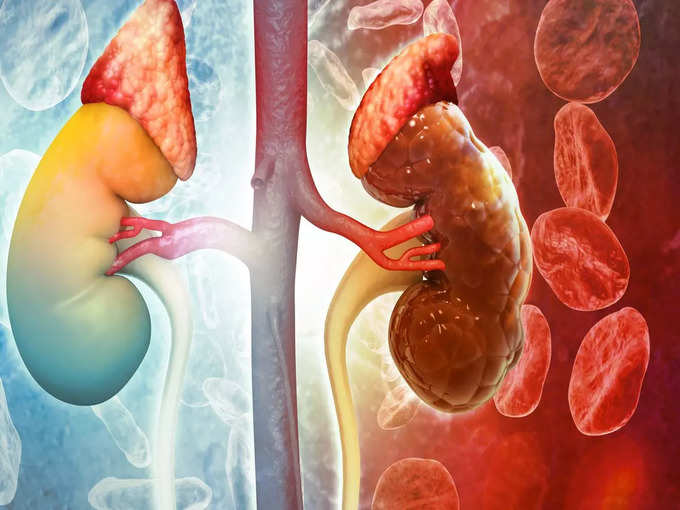 How serious is kidney cancer?