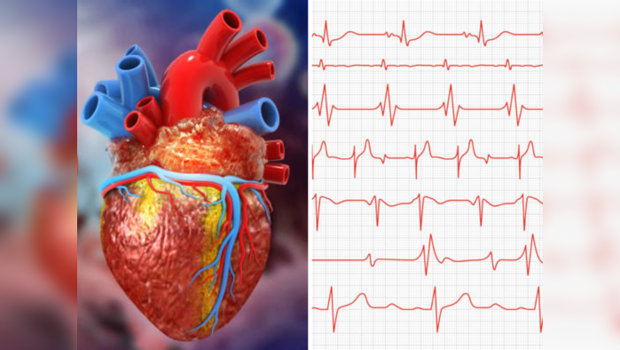 मिनी हार्ट अटॅक अधिक धोकादायक, त्याची लक्षणे इतर रोगांसारखी दिसतात, त्वरीत करा हे काम
