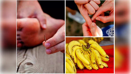 How to remove a splinter : कोणताही त्रास होऊ न देता या ५ उपायांनी काढा काटा