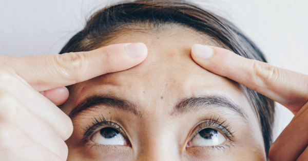 tips to treat the acne on forehead : माथे पर हो गए हैं पिंपल, तो दूर करने के लिए अपनाएं ये 4 तरीके
