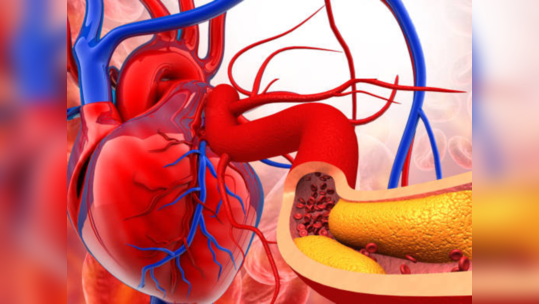 पोटात जाताच हे ४ पदार्थ वाढवतात LDL Cholesterol, कधीही येऊ शकतो हार्ट अटॅक