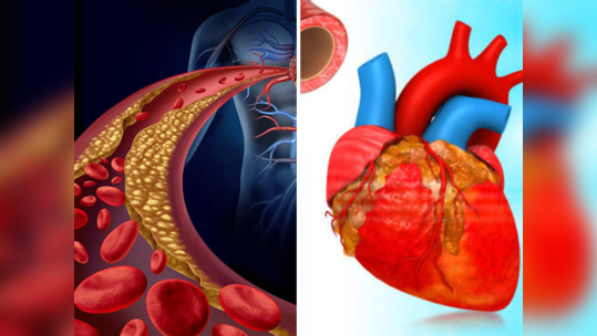 ५ गोष्टींचा कराल वापर तर त्वरीत कोसळेल कोलेस्ट्रॉल, घरच्या घरी मिळेल उत्तम रिझल्ट