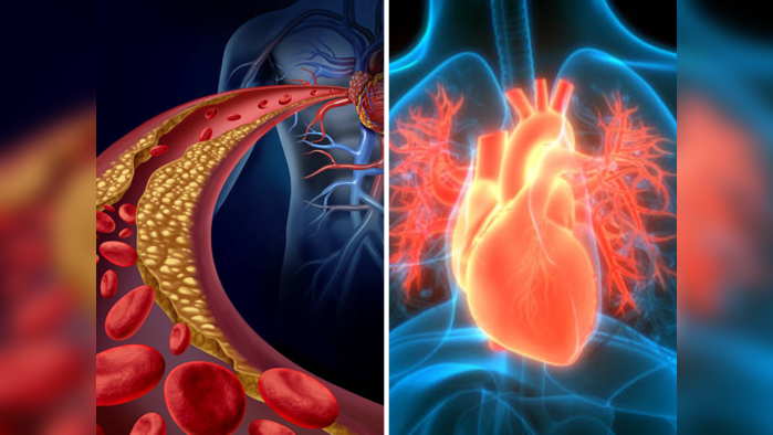 Reduce Cholesterol: या 8 नैसर्गिक उपायांनी घाणेरडा कोलेस्ट्रॉल आटोक्यात ठेवा, औषधांची गरज ही भासणार नाही