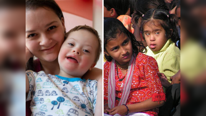 World Down Syndrome Day 2023: डाऊन सिंड्रोमच्या या ५ गोष्टी माहीत असायलाच हव्यात