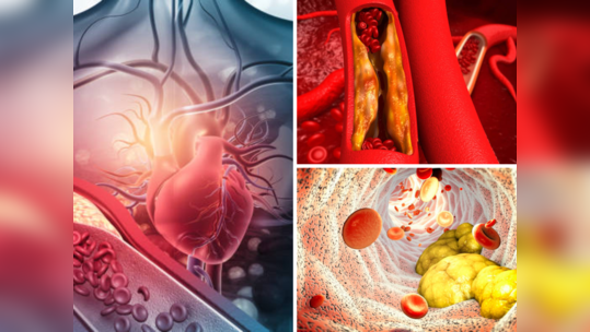 How To Lower Cholesterol: रक्तातील घाणेरडे कोलेस्ट्रॉल गाळून बाहेर फेकतात हे ५ पदार्थ, LDL रक्तात पोहचत नाही