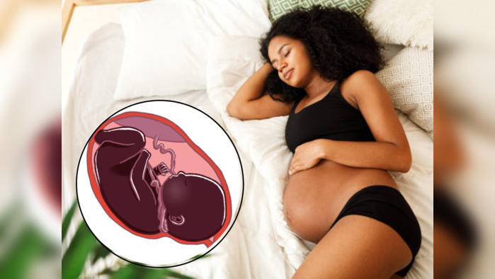 गर्भवती महिलेची झोपण्याची स्थिती गर्भाच्या गळ्यात नाळ गुंडाळली जाण्याला जबाबदार, डॉक्टरांच म्हणणं जाणून घ्या