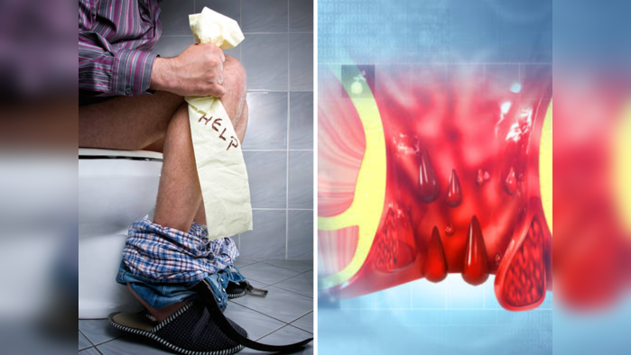 Constipation Remedies: ना औषध, ना पथ्यपाणी फक्त या गोष्टीने मिळेल आतडी पिळवटून टाकणाऱ्या बद्धकोष्ठतेपासून आराम