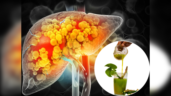 Liver Cleansing Herbs : लिव्हरमध्ये साचलेल्या विषारी पदार्थांना खेचून बाहेर फेकून देतील हे ५ आयुर्वेदिक हर्ब्स
