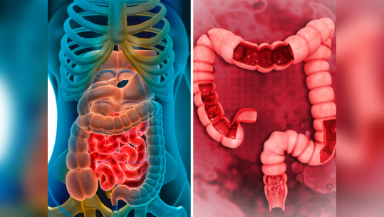 Cancer Symptoms : ही 10 लक्षणं देतात कॅन्सरच्या पेशी हळूहळू पूर्ण शरीरात पसरत असल्याचा इशारा, लगेच करा हे काम