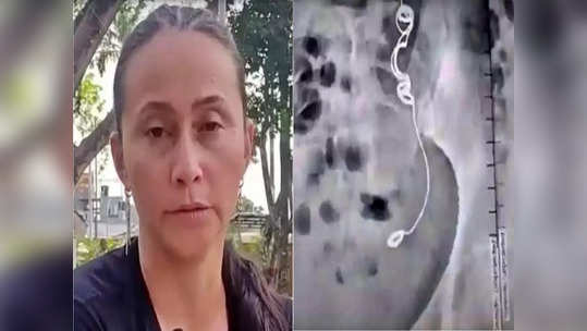 ११ वर्ष पोटात असह्य वेदना, पेनकिलर्सही आराम देईना, MRI करताच डॉक्टरही हादरले