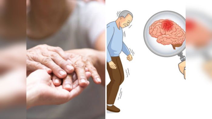 पार्किन्सन आजार नेमका काय आहे? Parkinson Disease ची लक्षणे