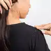 Packs Get Rid of Dandruff: ఈ హెయిర్‌ ప్యాక్స్‌తో.. చుండ్రు సమస్య దూరం ...