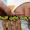 Chinese Baby Born with Rare Tail Birth Defect Doctors Confused - Baby ...