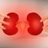 ICMR: కిడ్నీ మరణాలు తెలంగాణలోనే ఎక్కువ.. జాతీయ సగటును మించి, కారణం ఇదే..