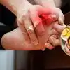 యూరిక్ యాసిడ్ + కీళ్ల వాపులు + నొప్పులు తగ్గడానికి సాయపడే 5 రకాల ఫుడ్స్, పరిశోధనల ప్రకారం ఏమేం తినాలో తెలుసా?