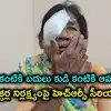 ఎడమ కంటికి బదులు కుడి కంటికి ఆపరేషన్.. ప్రైవేటు ఆస్పత్రి తీరుపై మానవ హక్కుల సంఘం ఆగ్రహం