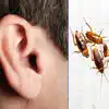 Cockroaches In Ear,అతడి చెవిలో పదుల సంఖ్యలో బొద్దింకలు.. ఏకంగా ఫ్యామిలీ ...