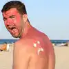 Heat Rashes,చెమట కాయల సమస్య? ఈ చిట్కాలు పాటిస్తే.. ఫుల్ రిలీఫ్ ...
