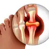 Fruits Increase Uric acid: యూరిక్‌ యాసిడ్‌ ఎక్కువైతే.. ఈ పండ్లు ...