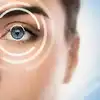Diabetic Eye Disease : சர்க்கரை நோயாளிகளுக்கு கண்களில் வரக்கூடிய ...