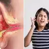 ear pain and swallowing : உணவை விழுங்கும் போது காதுவலிக்குதா.. என்ன ...