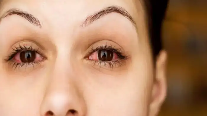 Eye Diseases After 40s : 40 வயதை தாண்டியதும் வரக்கூடிய ஆபத்தான 7 ...