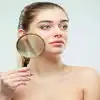 Gray Skin Causes and Treatment : உடலில் உறுப்பு செயலிழந்தால் தோல் இந்த ...