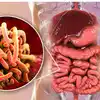 Parasites : உடலில் புழுக்கள் வளர என்ன காரணம்.. அறிகுறிகள்.. யாருக்கு வரும்?