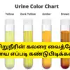 Changes In Urine Colour and Odour: உங்க சிறுநீரின் கலர், வாசனை வெச்சே ...