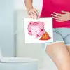 Orange Poop Causes: ஆரஞ்சு நிறத்தில் மலம் வெளியேறினால் என்ன காரணம் ...
