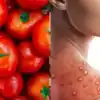 Tomato Allergy Diagnosis In Adults,தக்காளி சாப்பிடுவதால் வரும் அழற்சியை ...