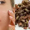 Wonderful Skin Benefits Of Magilampoo Or Spanish Cherry Flower Oil For ...