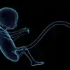 problems of umbilical cord Around Their Neck On Babies : சில குழந்தைகள் ...