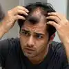 ​​Hair loss Causes: 90s கிட்ஸ் விட Gen Z தலைமுறையினருக்கு அதிகமாக முடி உதிர்வதற்கான காரணங்கள் என்ன?​