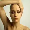 Female Baldness Causes,பெண்களே வழுக்கை மண்டை வராம இருக்கணுமா ...