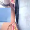 Eye Floaters,அடிக்கடி கண்ணுல புழு மாதிரி உருவம் தெரியுதா? இதுதான் ...