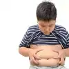 Childhood Obesity,2023 world obesity Day : உடல் பருமன், குண்டு குழந்தைங்க  உங்க வீட்லயும் உருவாகலாம், என்ன செய்வது, எப்படி தடுப்பது? - world obesity  day what are the complication ...