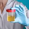 Causes Of Low Urine,low urine : கொஞ்சமா சிறுநீர் வெளியேற என்ன காரணம் ...