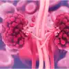 Kidney Problem Early Symptoms,ನಿಮ್ಮ ಕಿಡ್ನಿ ಹಾಳಾಗಿದೆ ಎಂದು ಗೊತ್ತು ...