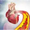 Signs Of High Cholesterol,ಹೆಚ್ಚಿನ ಕೊಲೆಸ್ಟ್ರಾಲ್ ಇದ್ದರೆ ನಿಮ್ಮ ಹೃದಯ ಈಸ್ ...