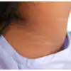 Dark Neck Treatment: ಕುತ್ತಿಗೆ ಭಾಗದ ಕಪ್ಪು ಹೋಗಲಾಡಿಸುವ ಸುಲಭ ಮನೆ ಮದ್ದುಗಳು ...