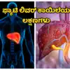 ಈ ಲಕ್ಷಣಗಳಿದ್ರೆ ಅದನ್ನು ಫ್ಯಾಟಿ ಲಿವರ್ ಕಾಯಿಲೆ ಅಂತಾರೆ ನಿರ್ಲಕ್ಷ್ಯ ಬೇಡ
