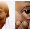 ನಟ ಸಂತೋಷ್ ಬಾಲರಾಜ್ ಅವರಿಗೆ ಈ ಜಾಂಡೀಸ್ ಕಾಯಿಲೆಯೇ ಕಂಠಕವಾಯಿತು! ಹೇಗಿರುತ್ತೆ ಈ ...