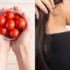 Home Remedies:tomato Can Be A Natural Medicine For Your Dandruff ...